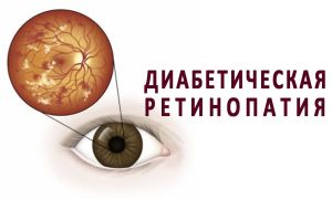 Диабетическая ретинопатия — хотите сохранить зрение, не тяните с лечением